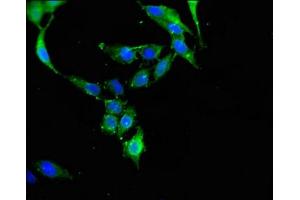Immunofluorescent analysis of Hela cells using ABIN7150995 at dilution of 1:100 and Alexa Fluor 488-congugated AffiniPure Goat Anti-Rabbit IgG(H+L) (CBL 抗体  (AA 548-847))