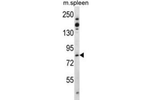 Western Blotting (WB) image for anti-TCDD-Inducible Poly(ADP-Ribose) Polymerase (Tiparp) antibody (ABIN3003615) (Tiparp 抗体)