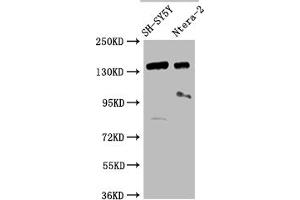 Western Blot Positive WB detected in: SH-SY5Y whole cell lysate, Ntera-2 whole cell lysate All lanes: ROBO2 antibody at 1:2000 Secondary Goat polyclonal to rabbit IgG at 1/50000 dilution Predicted band size: 131, 152, 154 kDa Observed band size: 152 kDa (ROBO2 抗体  (AA 450-660))