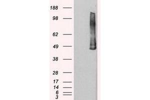 Image no. 2 for anti-Polo-Like Kinase 1 (PLK1) antibody (ABIN1500282) (PLK1 抗体)