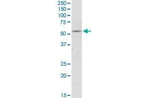THRA polyclonal antibody (A01). (THRA 抗体  (AA 87-178))