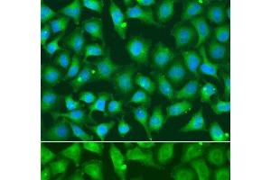 Immunofluorescence analysis of A549 cells using XRCC2 Polyclonal Antibody (XRCC2 抗体)