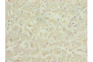 Immunohistochemistry of paraffin-embedded human heart tissue using ABIN7166610 at dilution of 1:100