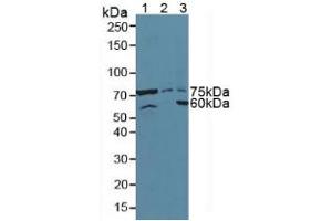Western blot analysis of (1) Mouse Pancreas Tissue, (2) Human HeLa cells and (3) Human 293T Cells. (ATF6 抗体  (AA 423-646))