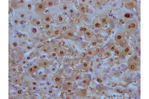 IHC image of ABIN7180448 diluted at 1:100 and staining in paraffin-embedded human liver tissue performed on a Leica BondTM system. (Liver Arginase 抗体)