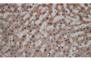 Immunohistochemistry of paraffin-embedded Rat liver using CALCRL Polyclonal Antibody at dilution of 1:50 (CALCRL 抗体)