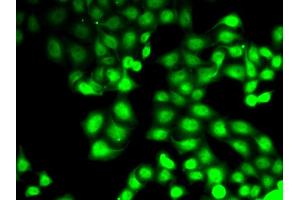 Immunofluorescence analysis of HeLa cells using GCK antibody. (GCK 抗体)
