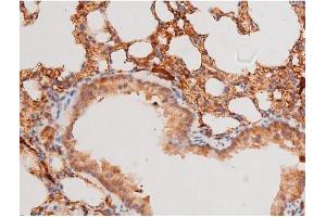 Immunohistochemistry (IHC) image for anti-Forkhead Box O4 (FOXO4) (pSer197) antibody (ABIN6255069)