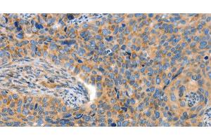 Immunohistochemistry (Paraffin-embedded Sections) (IHC (p)) image for anti-ADAM Metallopeptidase with thrombospondin Type 1 Motif, 18 (ADAMTS18) antibody (ABIN7240418)