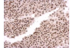 IHC-P Image Immunohistochemical analysis of paraffin-embedded HBL435 xenograft, using MAD1, antibody at 1:500 dilution.