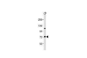 Anti-TAB2 Antibody (C-term)at 1:2000 dilution + C6 whole cell lysates Lysates/proteins at 20 μg per lane. (TAB2 抗体  (C-Term))