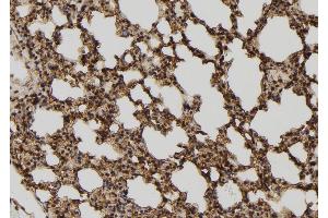 ABIN6272982 at 1/100 staining Mouse lung tissue by IHC-P. (TELO2 抗体  (Internal Region))