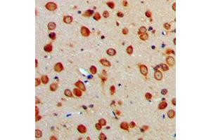 Immunohistochemical analysis of ERAP1 staining in human brain formalin fixed paraffin embedded tissue section. (ERAP1 抗体  (Center))