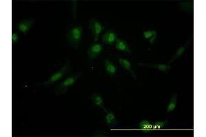 Immunofluorescence of monoclonal antibody to IRX5 on HeLa cell. (IRX5 抗体  (AA 204-264))