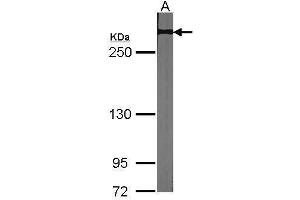 WB Image Sample (30 ug of whole cell lysate) A:NIH-3T3 5% SDS PAGE antibody diluted at 1:1000 (NOTCH2 抗体  (C-Term))