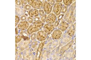 Immunohistochemistry of paraffin-embedded Mouse kidney using FDPS antibody at dilution of 1:100 (x400 lens). (FDPS 抗体)