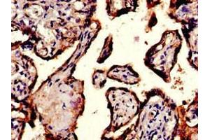 Immunohistochemistry of paraffin-embedded human placenta tissue using ABIN7156442 at dilution of 1:100 (ITGA5 抗体  (AA 220-472))
