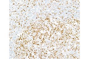 Immunohistochemistry (IHC) image for anti-Antigen Identified By Monoclonal Antibody Ki-67 (MKI67) (AA 1200-1250) antibody (ABIN7448915)