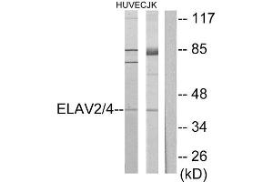 Western Blotting (WB) image for anti-ELAV2/4 (ELAV2/4) (Internal Region) antibody (ABIN1849272) (ELAV2/4 抗体  (Internal Region))