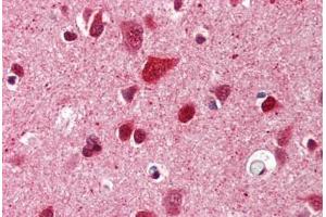 Brain, cortex, Human: Formalin-Fixed, Paraffin-Embedded (FFPE) (Ubiquitin 抗体)