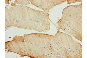 Immunohistochemistry of paraffin-embedded human skeletal muscle tissue using ABIN7159778 at dilution of 1:100 (MAP1LC3A 抗体  (AA 1-120))