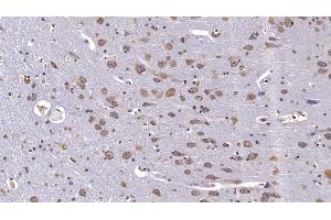 Detection of RELN in Human Cerebrum Tissue using Monoclonal Antibody to Reelin (RELN) (Reelin 抗体  (AA 2978-3373))