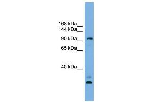 WB Suggested Anti-CCDC110 Antibody Titration: 0. (CCDC110 抗体  (Middle Region))
