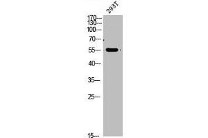 Western Blot analysis of 293t cells using primary antibody diluted at 1:1000(4 °C overnight). (FOXO4 抗体  (AA 170-200))