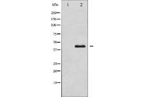 Western blot analysis of MEK1/2 expression in UV treated Jurkat whole cell lysates,The lane on the left is treated with the antigen-specific peptide. (MEK1 抗体  (Internal Region))