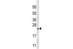 Western blot analysis of NQO2 antibody and mouse liver tissue lysate (NQO2 抗体  (AA 141-168))