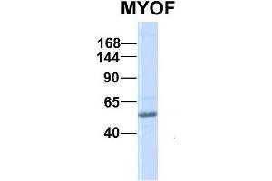 Western Blotting (WB) image for anti-Myoferlin (MYOF) (C-Term) antibody (ABIN2782797)