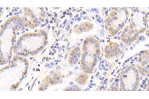 Detection of PRDX6 in Human Stomach Tissue using Polyclonal Antibody to Peroxiredoxin 6 (PRDX6) (Peroxiredoxin 6 抗体  (AA 1-224))