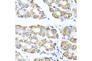 Immunohistochemistry of paraffin-embedded human gastric using SHMT1 antibody at dilution of 1:100 (x40 lens). (SHMT1 抗体)