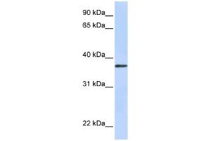 TTMB antibody used at 1 ug/ml to detect target protein. (TMEM200B 抗体  (N-Term))