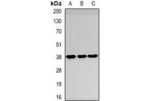 Western blot analysis of SPFH1 expression in HepG2 (A), NIH3T3 (B), Hela (C) whole cell lysates. (ERLIN1 抗体)