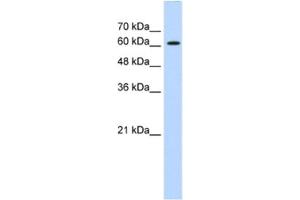 Western Blotting (WB) image for anti-ZIC2 (ZIC2) antibody (ABIN2461223) (ZIC2 抗体)
