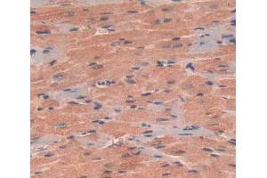 sed in DAB staining on fromalin fixed paraffin- embedded heart tissue (NT5M 抗体  (AA 30-193))