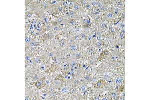 Immunohistochemistry of paraffin-embedded human liver using GLA antibody (ABIN1875410) at dilution of 1:100 (40x lens). (GLA 抗体)