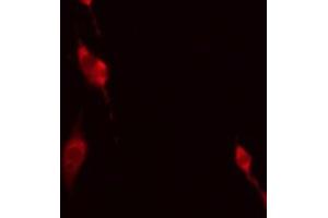 ABIN6275170 staining HeLa by IF/ICC. (GIMAP5 抗体  (Internal Region))