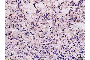Formalin-fixed and paraffin embedded mouse kidney tissue labeled Anti-Vimentin Polyclonal Antibody, Unconjugated (ABIN672786) at 1:200, followed by conjugation to the secondary antibody and DAB staining (Vimentin 抗体  (AA 371-466))
