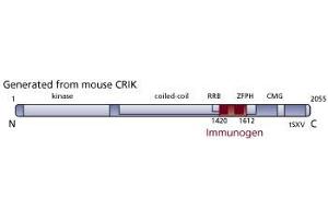 Image no. 3 for anti-Citron (Rho-Interacting, serine/threonine Kinase 21) (CIT) (AA 1420-1612) antibody (ABIN968503) (CIT 抗体  (AA 1420-1612))