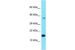 Host: Rabbit Target Name: FER1L6-AS2 Sample Type: Hela Whole cell lysates Antibody Dilution: 1. (FER1L6-AS2 抗体  (Middle Region))