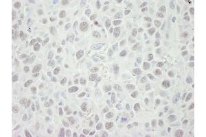 Immunohistochemistry (IHC) image for anti-Minichromosome Maintenance Complex Component 5 (MCM5) (AA 1-50) antibody (ABIN7448655) (MCM5 抗体  (AA 1-50))