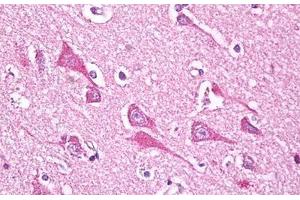 Anti-NDUFS7 antibody IHC staining of human brain, cortex neurons. (NDUFS7 抗体  (AA 58-68))