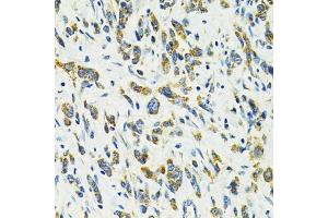 Immunohistochemistry (IHC) image for anti-Solute Carrier Family 25 (Mitochondrial Carrier, Oxoglutarate Carrier), Member 11 (SLC25A11) (AA 1-314) antibody (ABIN6147903)