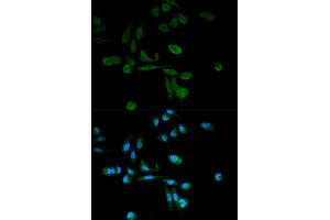 Immunofluorescence analysis of HeLa cells using SIRT7 antibody. (SIRT7 抗体)