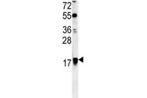 ARF1 antibody western blot analysis in Ramos lysate (ARF1 抗体  (AA 80-106))