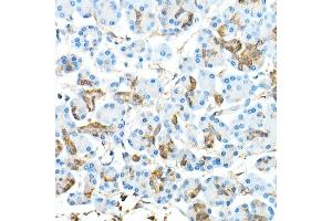Immunohistochemistry (IHC) image for anti-Caudal Type Homeobox 2 (CDX2) antibody (ABIN7266152)