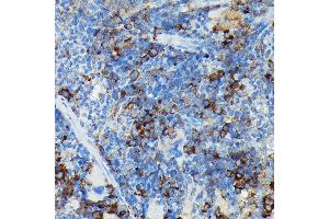 Immunohistochemistry (IHC) image for anti-Cylindromatosis (Turban Tumor Syndrome) (CYLD) (AA 654-953) antibody (ABIN1679467)