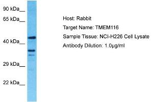 Host: Rabbit Target Name: TMEM116 Sample Tissue: Human NCI-H226 Whole Cell Antibody Dilution: 1ug/ml (TMEM116 抗体  (C-Term))